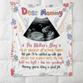 Custom Sonogram Photo Blanket - Personalized Gift for New Mom Mother's Day, Ultrasound Picture Throw for Expecting Mom, Pregnancy Announcement Keepsake Phot Blanket (Style 02)