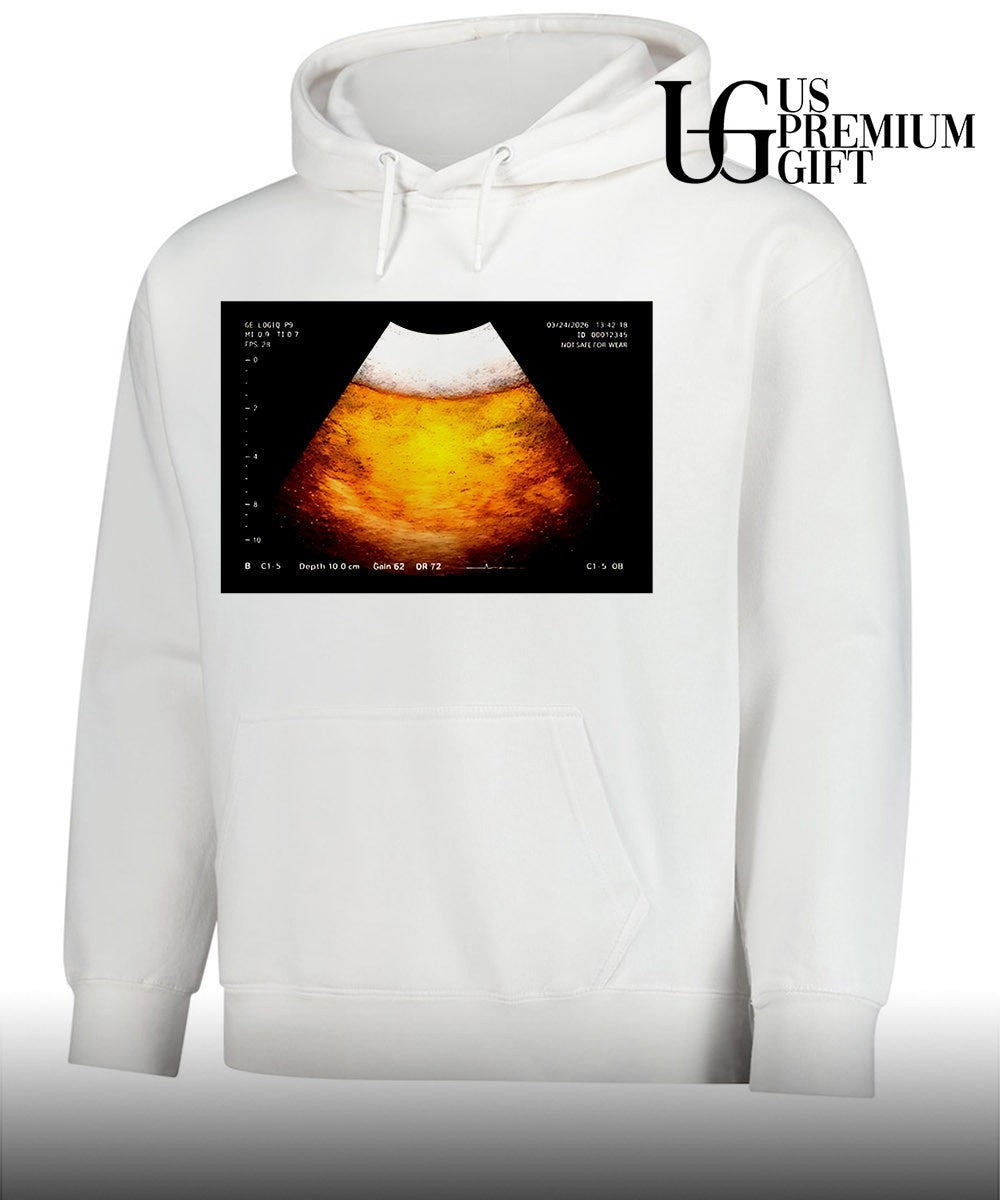 Beer Ultrasound shirt