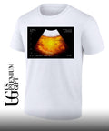 Beer Ultrasound shirt
