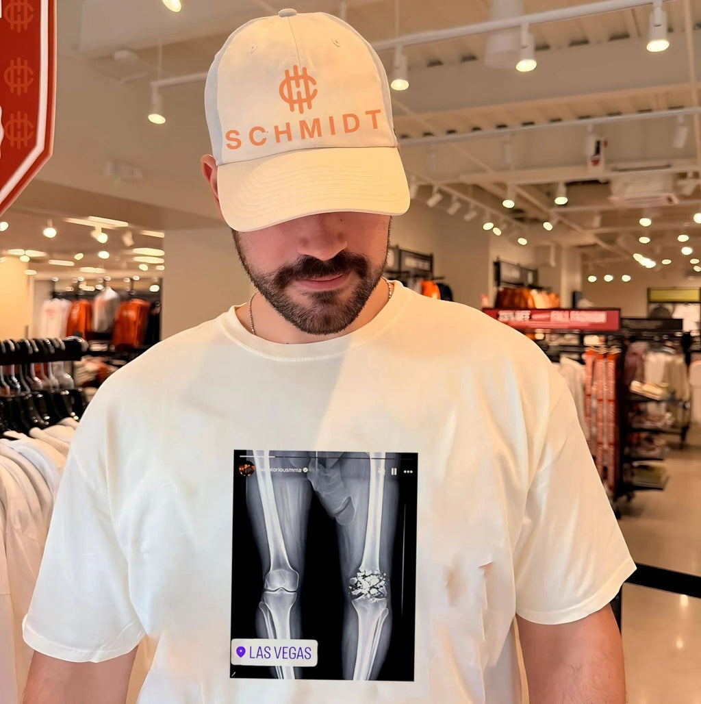 Conor McGregor X-ray Broken Knee knee Funny shirt